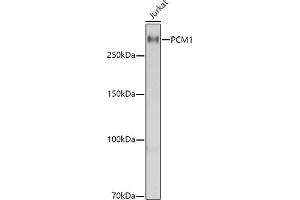 Western blot analysis of extracts of Jurkat cells, using PCM1 antibody  at 1:1000 dilution. (PCM1 Antikörper  (AA 1-260))