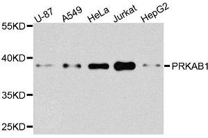 Western blot analysis of extracts of various cells, using PRKAB1 antibody. (PRKAB1 Antikörper)