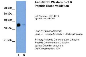 Host: Rabbit Target Name: TGFBI Sample Type: Jurkat Lane A: Primary Antibody Lane B: Primary Antibody + Blocking Peptide Primary Antibody Concentration: 2. (TGFBI Antikörper  (C-Term))