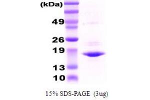 SDS-PAGE (SDS) image for Crystallin, alpha A (CRYAA) protein (ABIN666823) (CRYAA Protein)