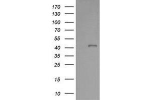 Image no. 2 for anti-Parvin, alpha (PARVA) antibody (ABIN1496441) (Parvin alpha Antikörper)