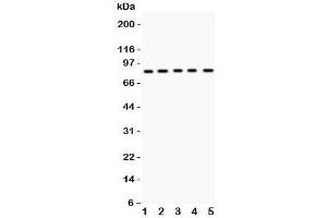 Western blot testing of MCAK antibody and Lane 1:  mouse testis;  2: human HeLa;  3: (h) MM231;  4: (h) MM453;  5: (h) SKOV lysate. (KIF2C Antikörper  (AA 531-725))