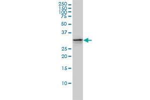 Western Blotting (WB) image for anti-Ubiquitin-Conjugating Enzyme E2R 2 (UBE2R2) (AA 1-238) antibody (ABIN565788)