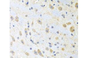 Immunohistochemistry of paraffin-embedded Mouse brain using MLN Polyclonal Antibody at dilution of 1:100 (40x lens).