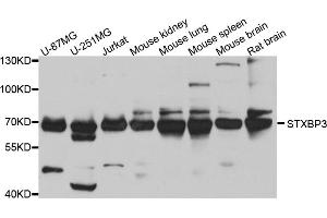 Western blot analysis of extracts of various cell lines, using STXBP3 antibody (ABIN5974503) at 1/1000 dilution. (STXBP3 Antikörper)
