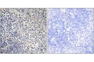 Immunohistochemistry analysis of paraffin-embedded human thymus gland tissue, using TPIP1 Antibody. (TP53AIP1 Antikörper  (AA 75-124))