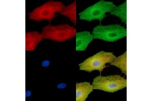 ABIN7096273 and ABIN7100335 staining  cells by IF/ICC. (VWA5B2 Antikörper)