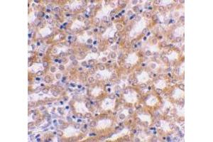 Immunohistochemical staining of mouse kidney using AP30447PU-N IRF3 antibody at 2 μg/ml. (IRF3 Antikörper  (C-Term))