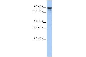 WB Suggested Anti-MCTP1 Antibody Titration:  1 ug/ml  Positive Control:  Hela cell lysate (MCTP1 Antikörper  (Middle Region))