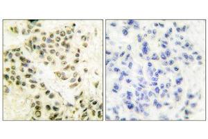 Immunohistochemistry (IHC) image for anti-Protein Kinase, DNA-Activated, Catalytic Polypeptide (PRKDC) (C-Term) antibody (ABIN1848510) (PRKDC Antikörper  (C-Term))