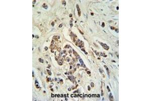 Immunohistochemistry (IHC) image for anti-ATP-Binding Cassette, Sub-Family C (CFTR/MRP), Member 11 (ABCC11) antibody (ABIN3002133) (ABCC11 Antikörper)