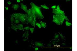 Immunofluorescence of monoclonal antibody to SDCBP on HepG2 cell. (SDCBP Antikörper  (AA 1-100))