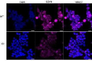 Immunocytochemical staining of HeLa cells using SOX9 antibody (ABIN7800973), 1:1,000), Top panel: wild-type (WT), Bottom panal: SOX9 shRNA knockdown (KD).