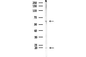 anti-Transforming Growth Factor, beta 1 (TGFB1) (C-Term) antibody