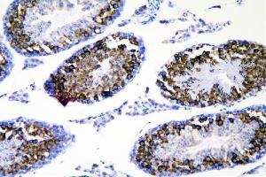 IHC analysis of DDX4 using anti-DDX4 antibody (ABIN7601203).