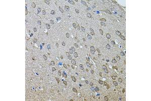 Immunohistochemistry of paraffin-embedded mouse brain using ANXA8L2 antibody (ABIN5975720) at dilution of 1/100 (40x lens). (ANXA8L2 Antikörper)