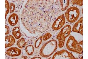 Immunohistochemistry (IHC) image for anti-Plastin 1 (PLS1) (AA 1-143) antibody (ABIN7163552)