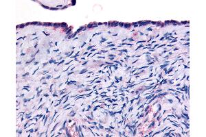 Anti-THRA antibody IHC of human surface epithelium. (THRA Antikörper  (Ligand Binding Domain))