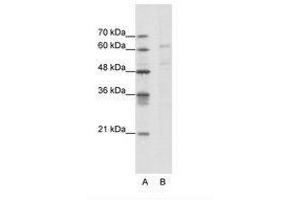 Image no. 1 for anti-Calcium Channel, Voltage-Dependent, beta 3 Subunit (CACNB3) (AA 391-440) antibody (ABIN202640) (CACNB3 Antikörper  (AA 391-440))