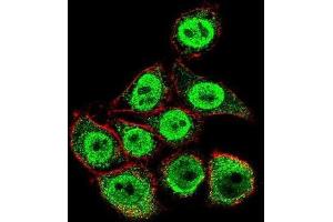Immunofluorescence (IF) image for anti-Thymidylate Synthetase (TYMS) antibody (ABIN3002747) (TYMS Antikörper)