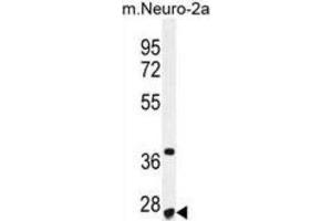 Western Blotting (WB) image for anti-CF153 antibody (ABIN2995840) (CF153 Antikörper)