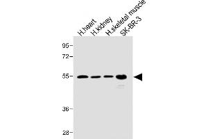 All lanes : Anti-SPNS2 Antibody (N-term) at 1:1000 dilution Lane 1: Human heart lysate Lane 2: Human kidney lysate Lane 3: Human skeletal muscle lysate Lane 4: SK-BR-3 whole cell lysate Lysates/proteins at 20 μg per lane. (SPNS2 Antikörper  (N-Term))