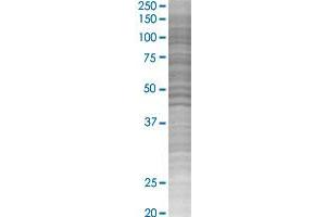 KIR3DL1 transfected lysate. (KIR3DL1 293T Cell Transient Overexpression Lysate(Denatured))