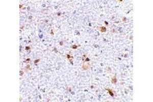 Immunohistochemistry (IHC) image for anti-Programmed Cell Death 1 Ligand 2 (PDCD1LG2) (Middle Region) antibody (ABIN1031035) (PDCD1LG2 Antikörper  (Middle Region))
