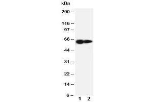 Western blot testing of IL-2 Receptor antibody and Lane 1:  PANC cell lysate (IL2 Receptor beta Antikörper  (AA 117-135))