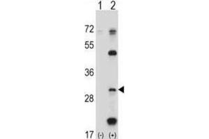 Western Blotting (WB) image for anti-Proteasome (Prosome, Macropain) Subunit, beta Type, 5 (PSMB5) antibody (ABIN2998050) (PSMB5 Antikörper)