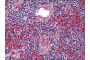 Immunohistochemistry: Human Thymus: Formalin-Fixed, Paraffin-Embedded (FFPE). (Cell Adhesion Molecule 4 Antikörper  (Internal Region))
