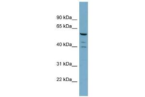 WB Suggested Anti-RABGEF1 Antibody Titration: 0. (RABGEF1 Antikörper  (N-Term))
