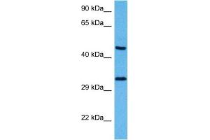 Host:  Mouse  Target Name:  SOX1  Sample Tissue:  Mouse Pancreas  Antibody Dilution:  1ug/ml (SOX1 Antikörper  (N-Term))