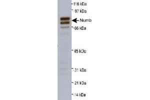 Western blot analysis of Numb isoforms 1 and 2 in A-431 whole cell lysate (20 ug) with Numb polyclonal antibody at 0. (NUMB Antikörper  (AA 600-653))