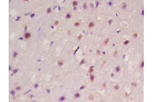 Formalin-fixed and paraffin embedded rat brain labeled with Rabbit Anti-Frizzled 10/CD350 Polyclonal Antibody, Unconjugated  at 1:200 followed by conjugation to the secondary antibody and DAB staining (FZD10 Antikörper  (AA 101-200))