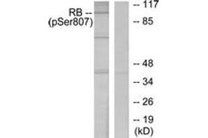 Western blot analysis of extracts from K562 cells treated with serum 10%, using Retinoblastoma (Phospho-Ser807) Antibody.