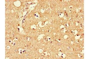 Immunohistochemistry of paraffin-embedded human brain tissue using ABIN7159344 at dilution of 1:100 (MLC1 Antikörper  (AA 1-49))