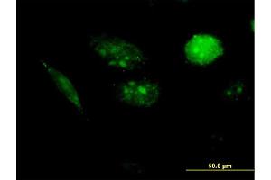 Immunofluorescence of purified MaxPab antibody to AURKAIP1 on HeLa cell. (AURKAIP1 Antikörper  (AA 1-199))