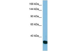 Western Blotting (WB) image for anti-Ubiquitin Specific Peptidase 36 (USP36) (N-Term) antibody (ABIN2787328) (USP36 Antikörper  (N-Term))