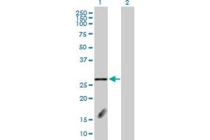 Western Blot analysis of FBXL18 expression in transfected 293T cell line by FBXL18 MaxPab polyclonal antibody. (FBXL18 Antikörper  (AA 1-259))