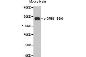 Western blot analysis of extracts from mouse Brain tissue, using phospho-GRIN1-S896 antibody (ABIN2987488). (GRIN1/NMDAR1 Antikörper  (pSer896))