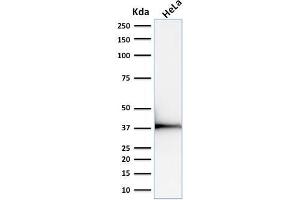 Western Blot Analysis of human HeLa cell lysate using Emerin Mouse Monoclonal Antibody (EMD/2168). (Emerin Antikörper  (AA 56-167))