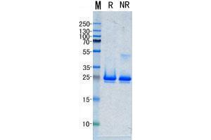 Western Blotting (WB) image for Tumor Necrosis Factor (Ligand) Superfamily, Member 11 (TNFSF11) (Active) protein (His tag) (ABIN5505579)
