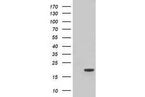 HEK293T cells were transfected with the pCMV6-ENTRY control (Left lane) or pCMV6-ENTRY TTC32 (Right lane) cDNA for 48 hrs and lysed. (TTC32 Antikörper)