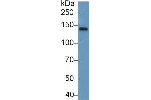 Detection of NEF3 in Mouse Spinal cord lysate using Polyclonal Antibody to Neurofilament 3 (NEF3) (NEFM Antikörper  (AA 105-287))