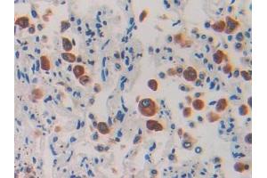 IHC-P analysis of Human Lung Tissue, with DAB staining. (IL1RAP Antikörper  (AA 65-249))