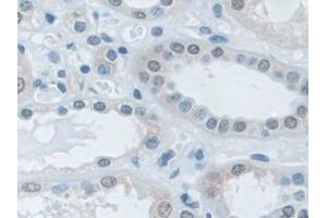 Immunohistochemistry (IHC) image for anti-Interleukin enhancer-binding factor 3 (ILF3) (AA 672-891) antibody (ABIN7442864)