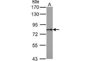 WB Image DDX3 antibody detects DDX3Y protein by Western blot analysis.