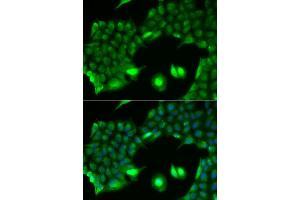 Immunofluorescence analysis of HeLa cell using SSX2 antibody. (SSX2 Antikörper)