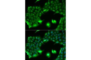 Immunofluorescence analysis of HeLa cell using SSX2 antibody.
